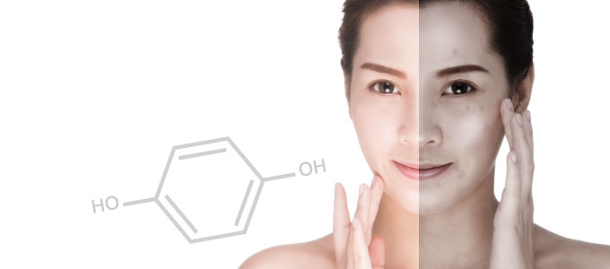 ハイドロキノンクリーム 皮膚科で採用されているその効果と副作用